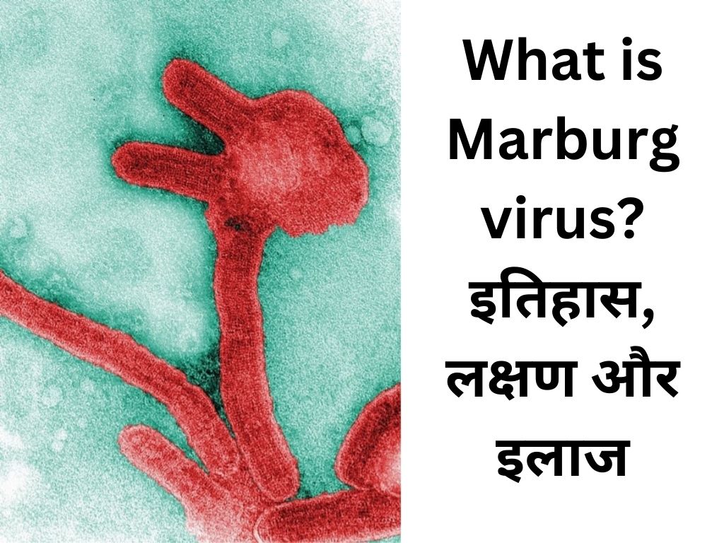 What is Marburg virus?, इतिहास, लक्षण और इलाज